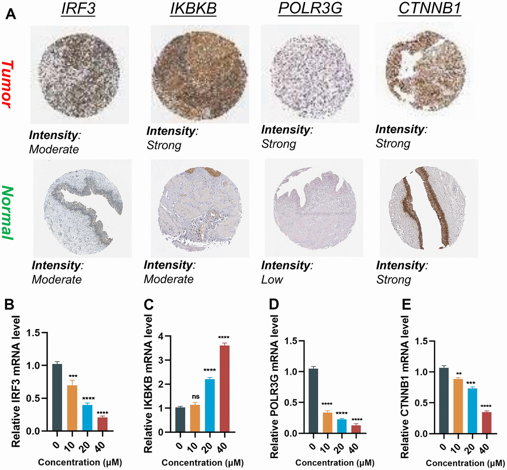 Validation of the expression of the signature genes in BLCA. (A) Immunohistochemistry of the IRF3, IKBKB, POLR3G, and CTNNB1 in the normal and tumor groups from the HPA database. (B–E) The expression of Hub gene at different concentrations of AUD-S100.