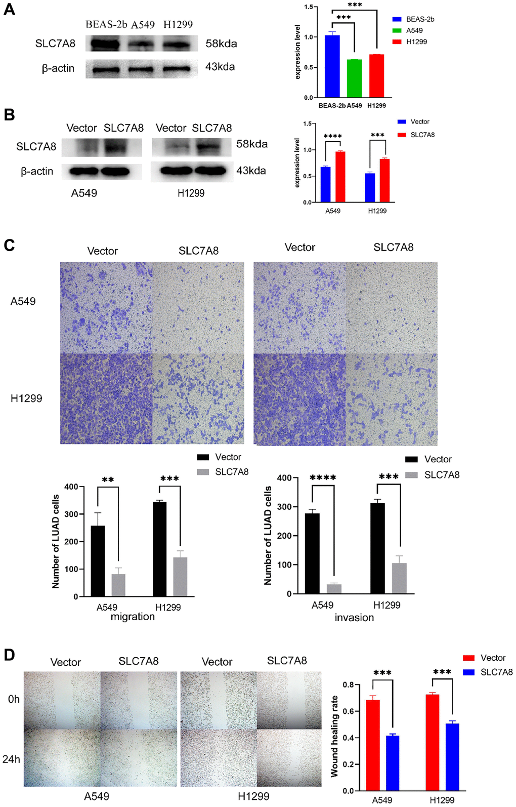 Overexpression of SLC7A8 suppresses the migration and invasion of LUAD. (A) The expression level of SLC7A8 in BEAS-2B, A549, and H1299 cells. (B) The protein expression levels were determined by Western blotting. (C) The migration and invasion were assessed using Transwell assays. (D) The migration ability was determined using wound healing assays as well.