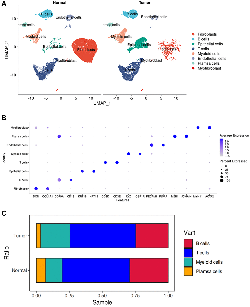 ScRNA-seq analysis of the tumor microenvironment in esophageal cancer cells. (A) The UMAP plot displays the cellular composition of the esophageal tumor microenvironment. (B) Dotplot showing marker gene expression in indicated cell types. (C) Histograms indicating the proportion of cells in tumor tissue and normal tissue.