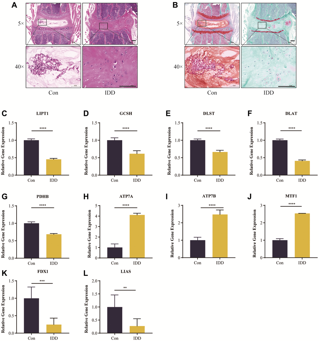 Histological staining analysis and RT-qRCR validation in vivo. Representative HE (A) and safranin O/green-stained (B) images of intervertebral discs in the control and IDD groups. (C–L) Cuproptosis genes FDX1, LIAS, LIPT1, GCSH, DLST, DLAT, and PDHB exhibited significantly lower expression levels in IDD NP samples than controls, while ATP7A, ATP7B and MTF1 displayed the opposite results. All results were expressed as mean ± standard deviation. **p ***p ****p 