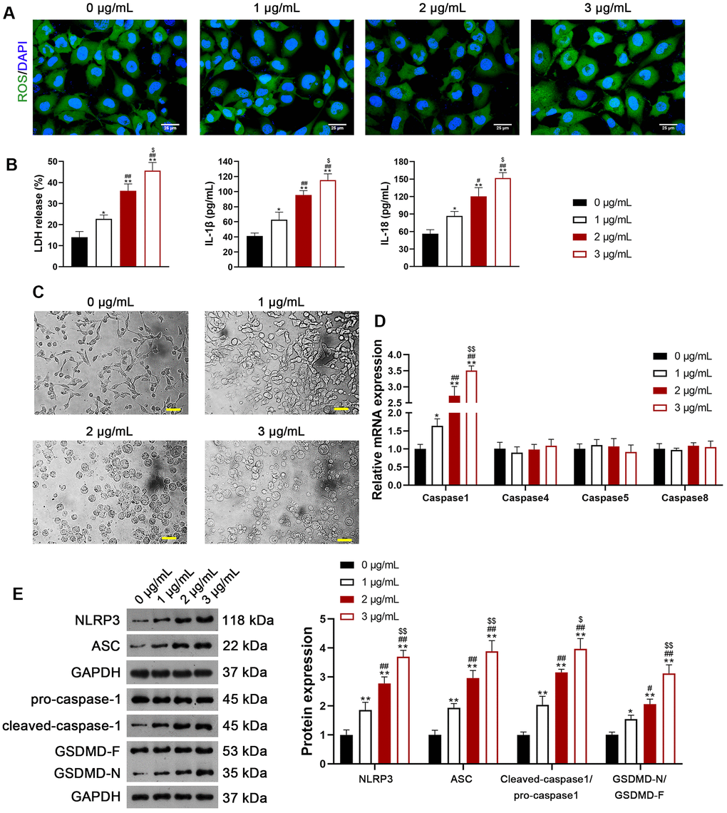 Usenamine A induces NLRP3/caspase-1/GSDMD-mediated pyroptosis in LUAD cells (H1299). (A) ROS levels in the cells were detected using a DCFH-DA probe. Scale bar = 25 μm. (B) LDH, IL-1β, and IL-18 levels in the cells were measured using commercial ELISA kits. (C) Representative morphological images of cells obtained by microscopic examination. Scale bar = 50 μm. (D) Relative expression of caspase-1, -4, -5, and -8 was analyzed using RT-qPCR. (E) Relative protein expression of NLRP3/caspase-1/GSDMD pathway-related proteins was measured using western blotting. *p p . 0 μg/mL usenamine A; #p p . 1 μg/mL usenamine A; $p p . 2 μg/mL usenamine A. GSDMD, gasdermin D; LUAD, lung adenocarcinoma; NLRP3, NOD-like receptor pyrin 3; RT-qPCR, reverse transcription-quantitative PCR.