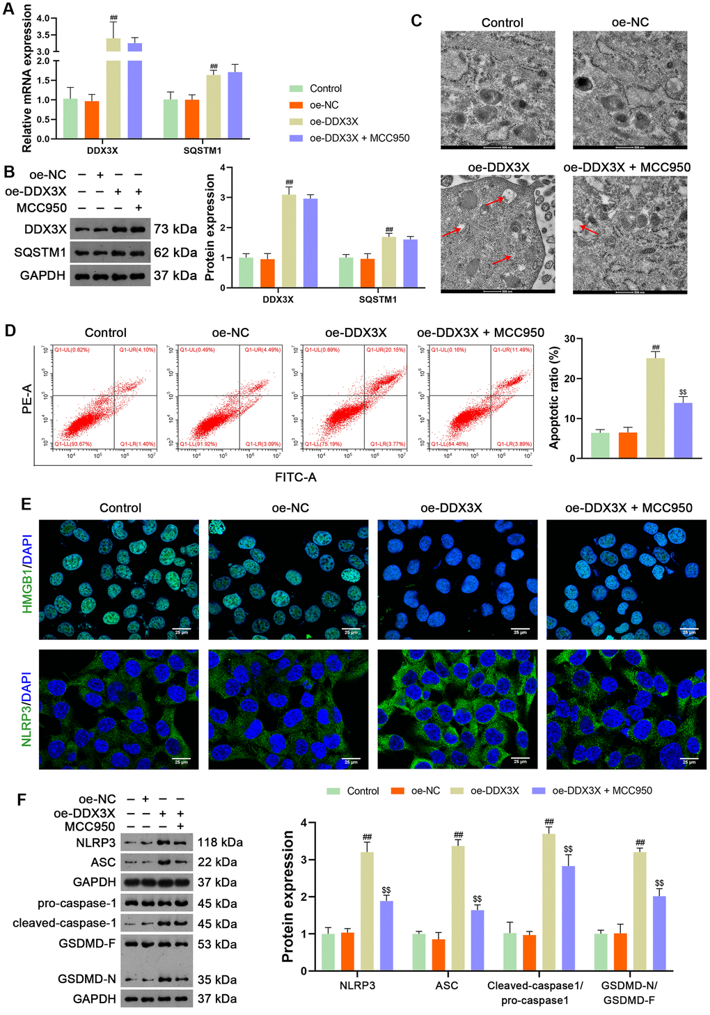 DDX3X overexpression promotes NLRP3/caspase-1/GSDMD-mediated pyroptosis in LUAD cells. (A, B) Relative mRNA and protein expression of DDX3X and SQSTM1 in H1299 cells were measured by RT-qPCR and western blotting, respectively. (C) Cell pyroptosis was observed by TEM. Scale bar = 500 nm. (D) H1299 cell apoptosis was measured by flow cytometry. (E) Expression of HMGB1 and NLRP3 were measured by immunofluorescence staining. Scale bar = 25 μm. (F) Relative protein expression of NLRP3/caspase-1/GSDMD pathway-related proteins was measured by western blotting. ##p . oe-NC; $$p . oe-DDX3X. DDX3X, DEAD-Box helicase 3 X-Linked; GSDMD, gasdermin D; LUAD, lung adenocarcinoma; NLRP3, NOD-like receptor pyrin 3; RT-qPCR, reverse transcription-quantitative PCR.