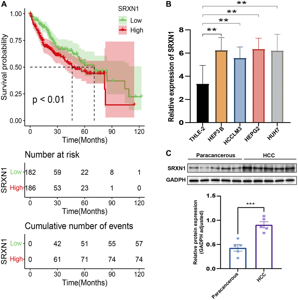 Validation of the risk score in HCC. (A) Survival analysis of TCGA-LIHC based on SRXN1 levels. (B) qRT-PCR images of tumor cell line (HEP3B, HCCLM3, HEPG2 and HUH7). SRXN1 levels were analyzed by qRT-PCR; **P C) Representative images of Western blots of the liver cell line (THLE-2) and tumor cell line (HEP3B). SRXN1 levels were determined by Western blot (mean ± SEM; n = 5; **P 