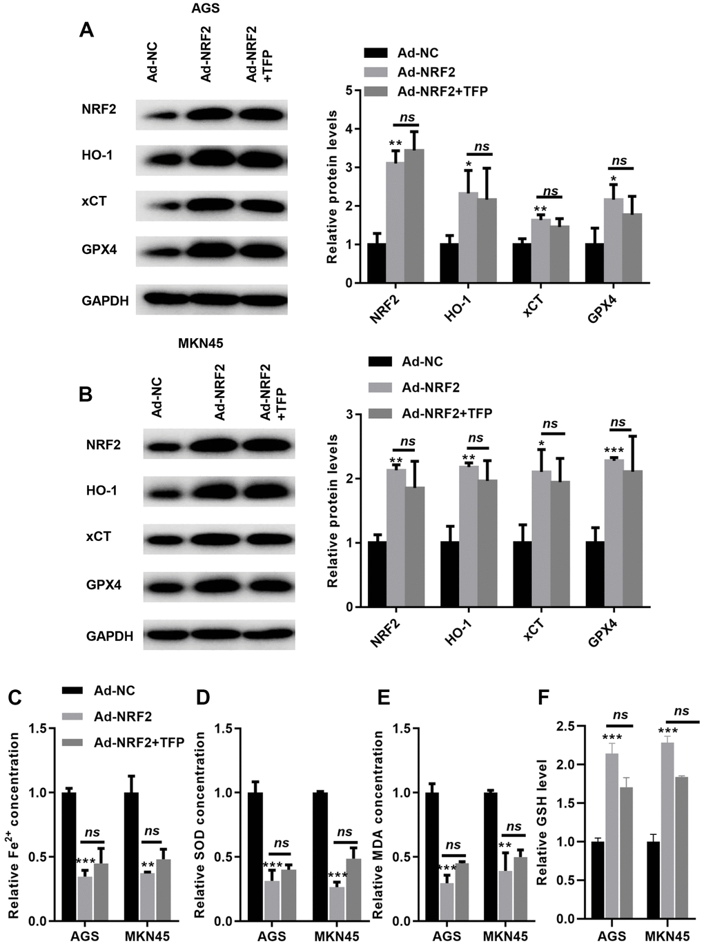 TFP-induced ferroptosis was mediated via NRF2 in gastric cancer cells. EBV-infected AGS and MKN45 cells were preincubated with TFP for 2 h. After that, Ad-NRF2 and Ad-NC were transfected into EBV-infected AGS and MKN45 cells for 24 h. Transfection with ad-NRF2 abolished TFP-induced suppression of HO-1, GPX4 and xCT in AGS (A) and MKN45 (B) cells. Overexpression of NRF2 reduced intracellular Fe2+ (C), SOD (D) and MDA (E) levels, even in the presence of TFP, in EBV-infected AGS and MKN45 cells. (F) Elevated NRF2 expression increased the level of GSH, and TFP pretreatment could not affect such effects in EBV-transfected GC cells. *p