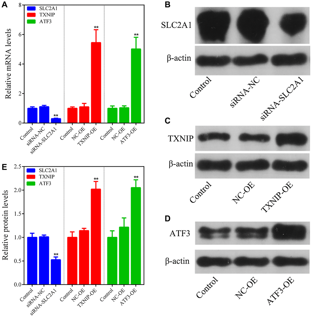 Transfection efficiency detection. (A) q-PCR analysis of the transfection efficiency of siRNA-SLC2A1, TXNIP overexpression plasmids, and ATF3 overexpression plasmids. (B–E) Western blot analysis of the transfection efficiency of siRNA-SLC2A1, TXNIP overexpression plasmids, and ATF3 overexpression plasmids. The bar graphs show the mean ± SD of at least three independent experiments (n = 3). **P 