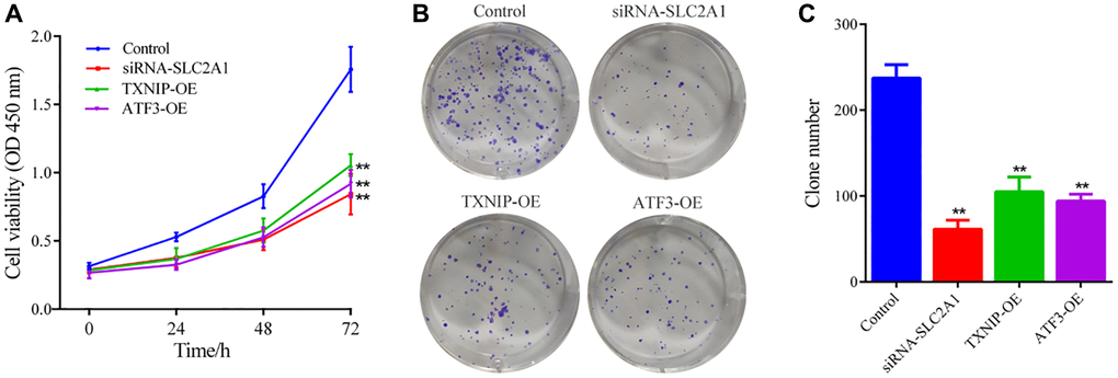 Cell growth ability detection. (A) CCK8 assay was used to detect the effects of SLC2A1, TXNIP, and ATF3 on the cell viability of MCF-7 cells. (B, C) Colony formation assay was used to detect the effects of SLC2A1, TXNIP, and ATF3 on the colony formation ability of MCF-7 cells. The data presented are the mean ± SD of at least three independent experiments (n = 3). **P 