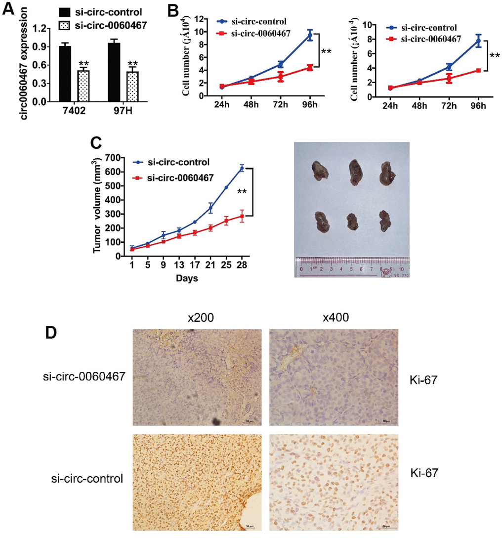 Knockdown of circ0060467 suppresses HCC tumor growth. (A) si-circ0060467 successfully knocked down circ0060467 in 7402 (left) and 97H (right) cells. (B) Cell Counting Kit-8 assay was performed to evaluate cell proliferation in 7402 and 97H cells. (C) Tumor volume was measured every 4 days for 4 weeks. (D) Expression status of Ki67 in hematoxylin-eosin-stained sections of harvested xenograft tumors. **p 