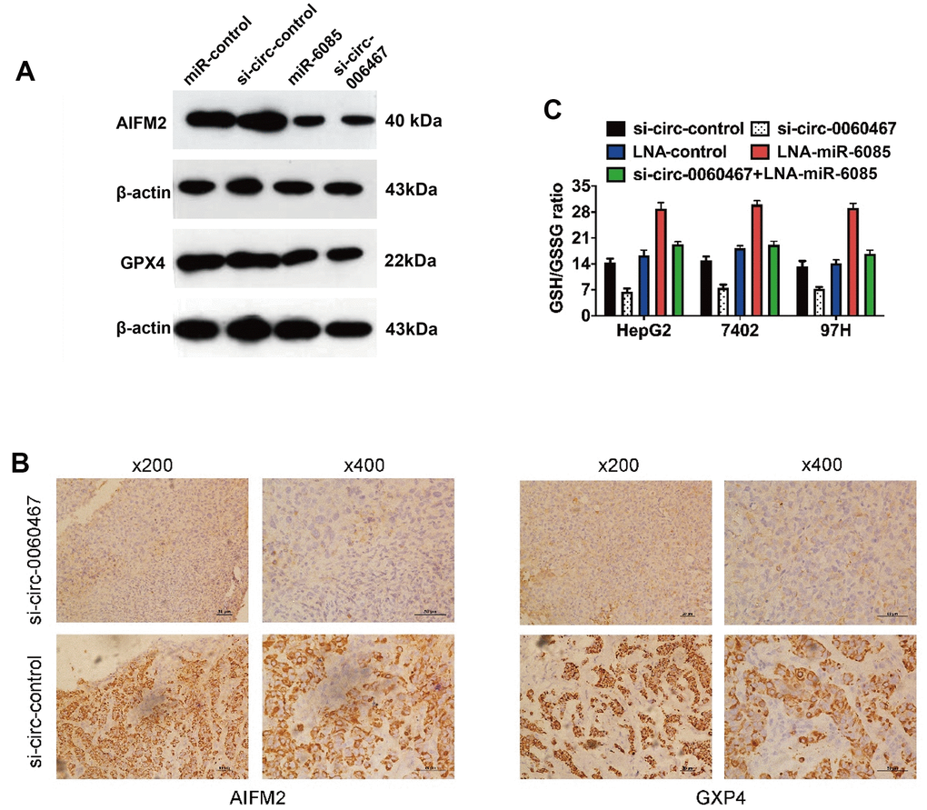 Knockdown of circ0060467 promotes ferroptosis in HCC. (A) Western blotting was performed to determine the expression levels of AIFM2, GPX4 and β-Actin. (B) Expression status of AIFM2 and GPX4 in hematoxylin-eosin-stained sections of harvested xenograft tumors. (C) Glutathione (GSH)/oxidized GSH (GSSG) ratio was determined with a GSH/GSSG Quantification Kit. **p 