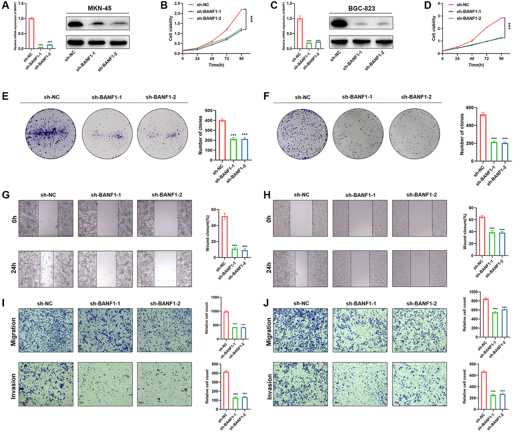 Knockdown of BANF1 inhibits the proliferation, migration and invasion ability of GC cells in vitro. (A) Knockdown efficiency of MKN-45 cell line was detected using RT-qPCR and WB. (B) CCK8 assay was used to detect the effect of BANF1 knockdown on the viability of MKN-45 cell line. (C) Knockdown efficiency of BGC-823 cell line was detected using RT-qPCR and WB. (D) CCK8 assay was used to detect the effect of BANF1 knockdown on the viability of BGC-823 cell line. (E, F) The effect of BANF1 knockdown on the proliferative capacity of MKN-45 and BGC-823 cells was detected by plate clone formation assay. (G, H) Effects of BANF1 knockdown on the migration ability of MKN-45 and BGC-823 cells were detected by wound healing assay. (I, J) Effect of BANF1 knockdown on the migration and invasion of MKN-45 and BGC-823 cells by Transwell assay. All experiments were repeated at least three times. ***p 