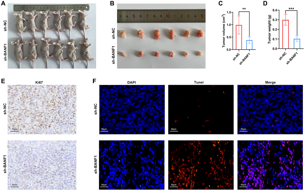 Knockdown of BANF1 inhibited tumor growth in in vivo experiments. (A) Photographs of nude mice injected with BANF1 knockdown MKN-45 (n = 6) and blank control MKN-45 cells (n = 6). (B) Photographs of subcutaneous tumors of nude mice in the knockdown group (n = 6) and control group (n = 6). (C, D) Comparison of subcutaneous tumor volume and weight of nude mice in knockdown and control groups. (E) Immunohistochemical staining of Ki67 in subcutaneous tumors of nude mice. (F) TUNEL staining of subcutaneous tumors in nude mice. All experiments were repeated at least three times. **p ***p 