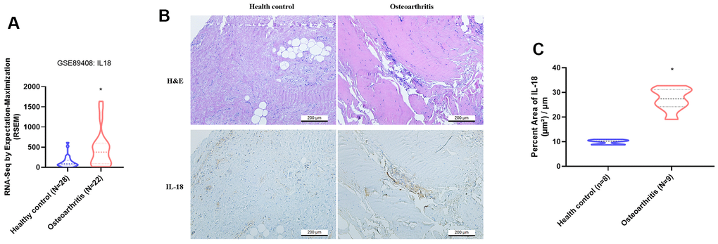 IL-18 is upregulated in clinical synovial tissue from OA patients. (A) Patterns of mRNA expression in the GEO dataset GSE890408 in synovial tissue samples from OA patients and normal healthy donors were used to analyze IL-18 expression. (B) Synovial tissues from the study cohorts of OA patients and normal healthy donors were subjected to H&E and IHC staining for detecting IL-18 expression. (C) Quantification of IHC results from Figure 1B. Results are expressed as the means ± S.D. *p