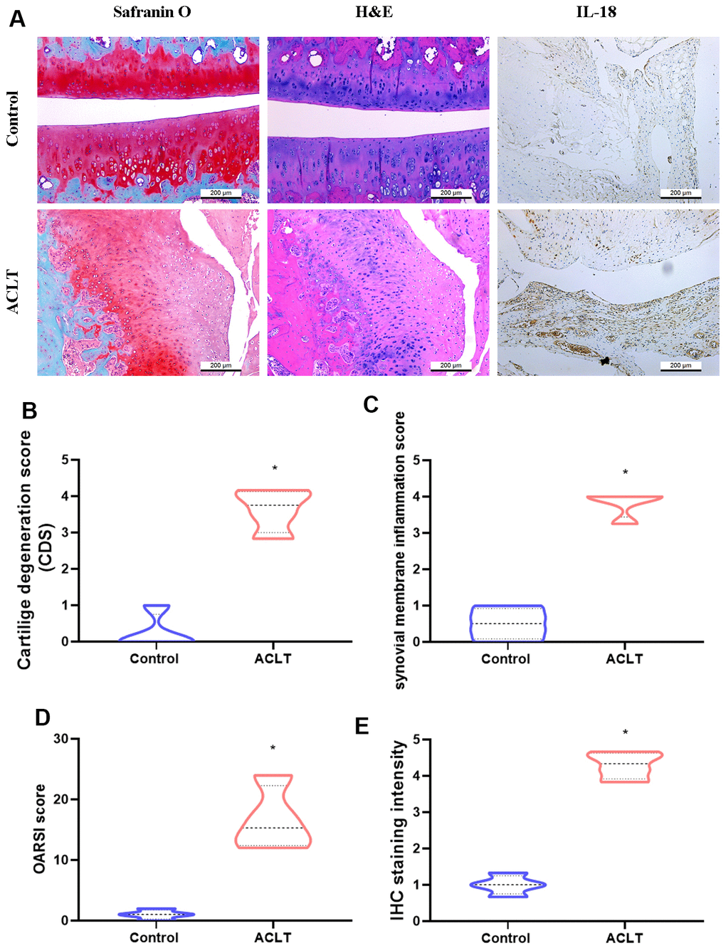Histologic assessments revealed increases in IL-18 expression in ACLT rats. (A) All rats were sacrificed at 8 weeks after surgery. Paraffin-embedded sections of knee joints were subjected to Safranin O/fast green, H&E, and IHC staining for analyses of IL-18 expression. (B–D) The severity of knee OA was assessed by cartilage degeneration scores (CDS), synovial membrane inflammation scores, and Osteoarthritis Research Society International (OARSI) scores. (E) Levels of IL-18 expression were evaluated by the intensity of IHC staining. Results are expressed as the means ± S.D. *p