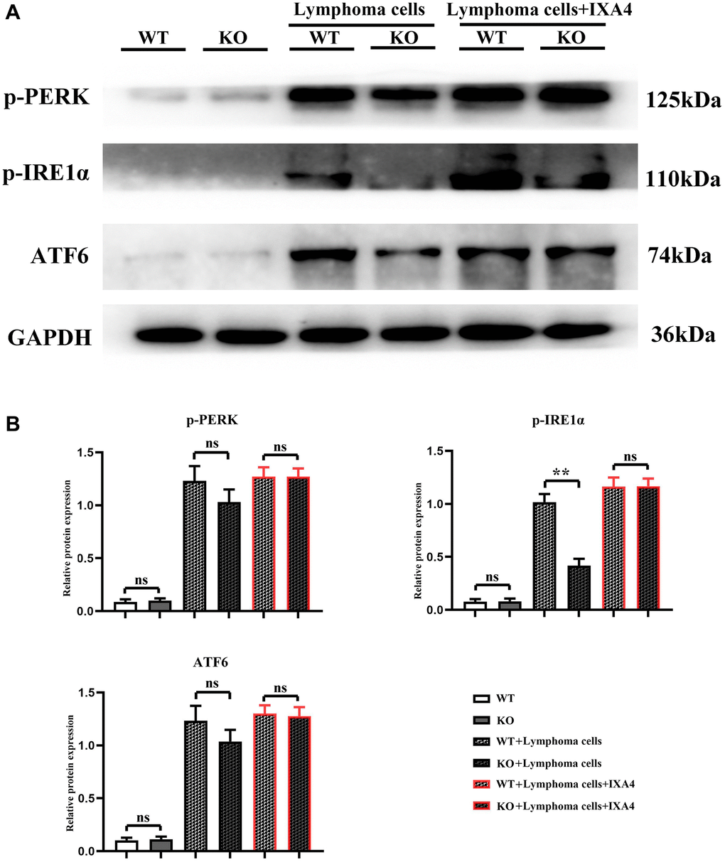 Western blotting of p-PERK, p-IRE1α and ATF6. (A) Protein bands of p-PERK, p-IRE1α and ATF6; (B) Relative protein expressions of p-PERK, p-IRE1α and ATF6. (WT group vs. KO group; WT + lymphoma cell group vs. KO + lymphoma cell group; WT + lymphoma cell + IXA4 group vs. KO + lymphoma cell + IXA4 group; **P nsP > 0.05; N = 3).