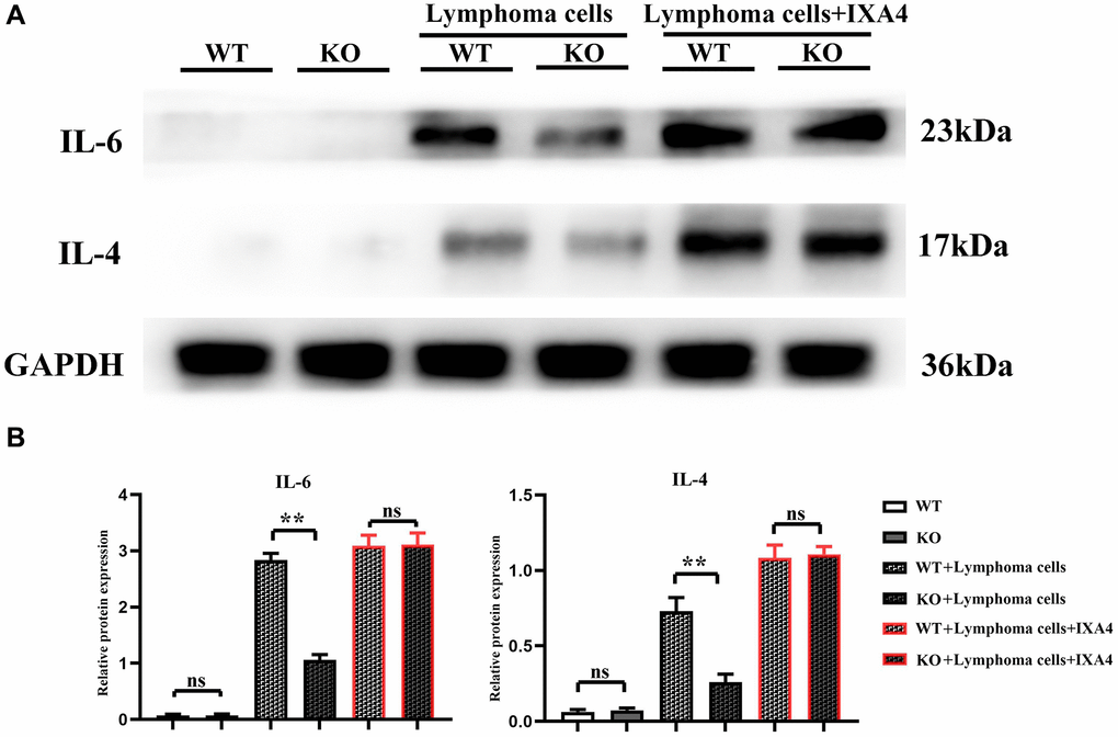 Western blotting of IL-4 and IL-6. (A) Protein bands of IL-4 and IL-6; (B) Relative protein expressions of IL-4 and IL-6. (**P N = 3).