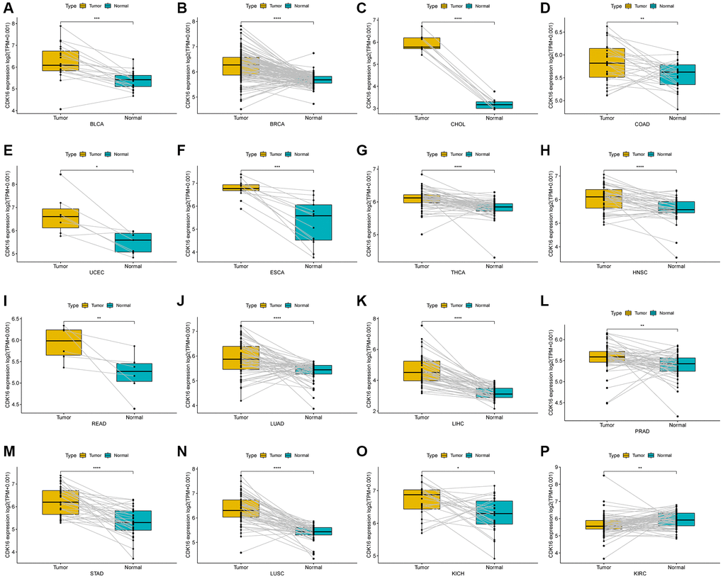 Expression of CDK16 in paired tumor and adjacent normal tissues. (A–P) CDK16 expression in paired tumor and adjacent normal tissues from TCGA in indicated tumor types. *P **P ***P ****P 