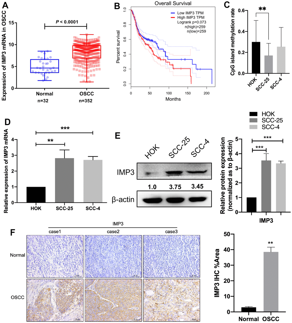 Overexpression of IMP3 in human OSCC tissues and cell lines. (A) TCGA analysis showed that IMP3 mRNA levels were increased in the OSCC tissues (n=352) compared with the normal tissues (n=32). (B) Kaplan-Meier analysis was performed on OSCC patient survival with the GEPIA database according to high or low expression of IMP3. (C) Methylation sequencing results showed that the high expression of IMP3 in oral squamous cell carcinoma was probably related to CpG island methylation modification. Expression level of IMP3 mRNA (D) and protein (E) in OSCC cell lines (SCC-25 and SCC-4) in comparison with HOK cell line. (F) The IHC score of IMP3 was markedly higher in the OSCC tissues than in the adjacent normal tissues (n=40). Magnification ×40. The scale bar indicates 50 μm. Relative expression levels were calculated using the image J software (n = 3). P≤ 0.05 was considered to be statistically significant, **P P
