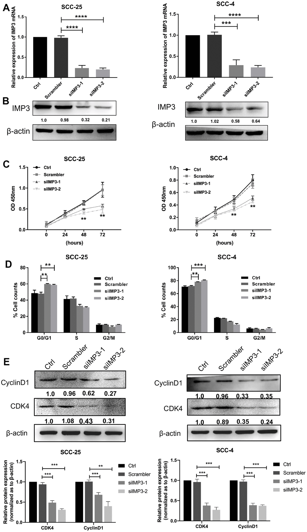 Knockdown of IMP3 inhibits OSCC proliferation. The expression of IMP3 in SCC-25 and SCC-4 cells transfected with IMP3 siRNA was determined by qRT-PCR (A) and Western blot (B). (C) Cell growth in OSCC cells transfected with siIMP3 as measured by CCK8 assay(n=5). (D) Effects of suppression of IMP3 on the cell cycle progression of SCC-25 and SCC-4 cells measured by flow cytometric analysis. (E) Expression analysis for cell cycles regulators Cyclin D1 and CDK4 was performed by Western blot. Relative expression levels were calculated using the image J software (n = 3). P ≤ 0.05 was considered to be statistically significant, **P P P 