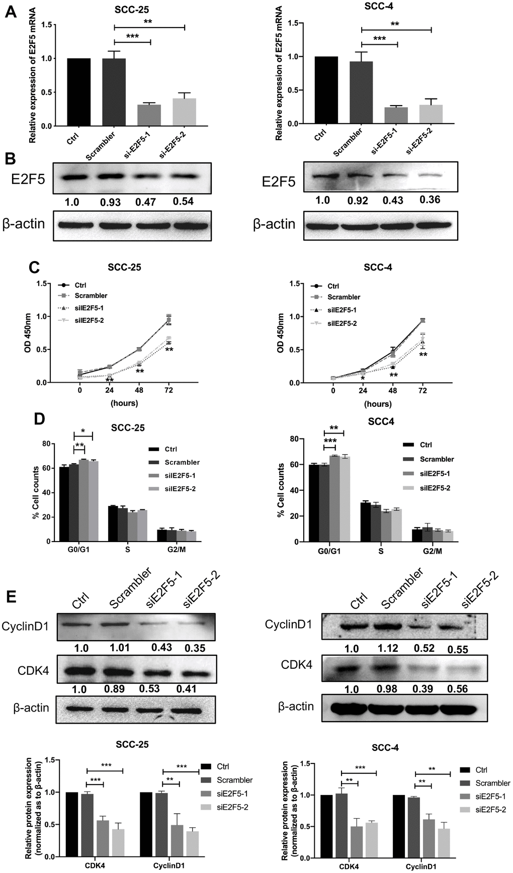 Effects of E2F5 inhibition on OSCC cell growth. The expression of E2F5 was analyzed with qRT-PCR (A) and Western blot (B) after transfection with siE2F5 and its control. (C) Cell viability of SCC-25 and SCC-4 cells transfected with siE2F5 was determined by the CCK8 assay (n=5). (D) Effects of suppression of E2F5 on the cell cycle progression of OSCC cells measured by flow cytometric analysis. (E) Expression analysis for cell cycles regulators Cyclin D1 and CDK4 was performed by Western blot. Relative expression levels were calculated using the image J software (n = 3). P ≤ 0.05 was considered to be statistically significant, *P P P 