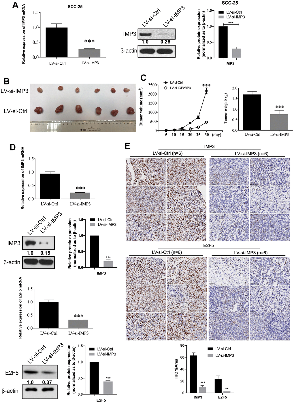 IMP3-depleted inhibits OSCC cell proliferation. (A) Establishment of IMP3-depleted SCC-25 cells. The expression of IMP3 was analyzed with qRT-PCR and Western blot. Relative expression levels were calculated using the image J software (n = 3). (B) Stable IMP3-depleted SCC-25 cells and control cells were subcutaneously injected into nude mice. A representative image showing tumors from mice transplanted with SCC-25 cells with or without IMP3 inhibition. (C) The tumor growth and the tumor weights from each group were statistically analyzed (n=6). (D) qRT-PCR and Western blot analysis showed that IMP3 and E2F5 levels were increased in the tissues compared with the control tissues. (E) IHC staining of IMP3 (up) and E2F5 (down) in tumor tissues from mice implanted with SCC-25-LV-si-IMP3 or SCC-25-LV-si-Ctrl cells. Magnification ×40. Scale bar, 50 μm. Relative expression levels were calculated using the image J software (n = 6). P ≤ 0.05 was considered to be statistically significant, *P P P 