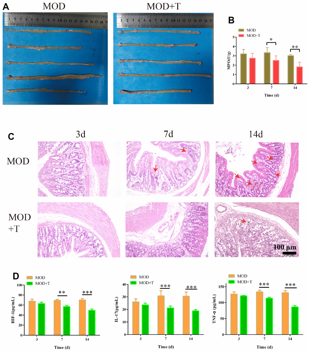 The protective effect of TXYF on UC rat model. (A) The colon in UC model group (MOD) and UC model+ TXYF group (MOD+T) at 14th day after the UC model was established. (B) The activity of Myeloperoxidase (MPO) in MOD and MOD+T groups was measured at 3rd, 7th, and 14th day after the UC model was established. (C) The representative images of hematoxylin-eosin (H&E) staining of colon collected from MOD and MOD+T groups at 3rd, 7th, and 14th day after the UC model was established. (D) The concentration of HIF-1, IL-17 and TNF-α in MOD and MOD+T groups was measured at 3rd, 7th, and 14th day after the UC model was established. N=5, *p