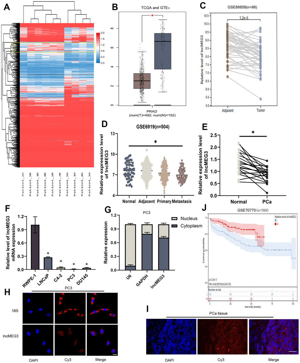 LncMEG3 was downregulated and indicated a poor clinical prognosis in PCa. (A) Differential genes between carcinoma and paracancerous tissues in patients with PCa (n=5). (B) The expression level of lncMEG3 was lower in PCa than in normal tissues in TCGA-PRAD and GTEx database. (C) LncMEG3 show a significant differences in cancerous and paracancerous tissues (GSE88808). (D) The expression level of lncMEG3 exhibit a declining tendency with the progression of PCa (GSE6919). (E) The expression levels of lncMEG3 in 20 PCa tissues and paired normal tissues. (F) The expression levels of lncMEG3 in four PCa cell lines (LNCaP, C4-2, PC3 and DU145) and normal cell line (RWPE-1). (G) Localisation of lncMEG3 was assessed by PCR in PC3 cell line. U6 and GAPDH were used as positive controls for nuclear RNA and cytoplasmic RNA, respectively. (H, I) The distribution of lncMEG3 was also analysed by FISH in PC3 cells (Scale bar, 20μm) and PCa tissues (Scale bar, 50μm). 18S showed in the cytoplasm. (J) The patients with lower level of lncMEG3 were more likely to have biochemical recurrence according to the dates from GSE70770, * P 