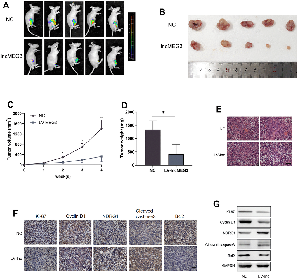 Elevating lncMEG3 inhibits PCa proliferation and promotes apoptosis in vivo. (A) Images of the tumors in the subcutaneous mouse model. (B) Images of subcutaneous tumors formed by the PC3 cells. (C, D) Growth curves and weight analyses of subcutaneous tumors formed by PC3 cells, * P E) H&E staining revealed that the tumor cells in the LV-lnc group were loosely arranged and had less vascular compared with the control group, scale bar 20 μm. (F) IHC staining of tumor in situ showed the difference between the LV-lnc group and LV-control group, scale bar 20 μm. (G) Western blot of proteins changed in tumor tissues.