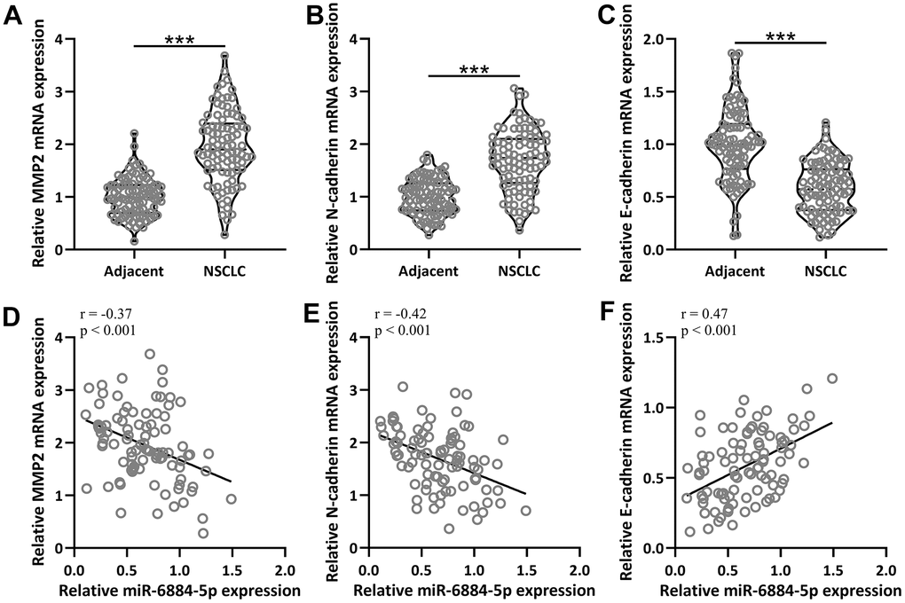 The mRNA expressions of MMP2, N-cadherin and E-cadherin between adjacent tissues and NSCLC tissues (n = 92 for each). (A–C) qRT-PCR was used to determine the mRNA levels of MMP2, N-cadherin and E-cadherin. Violin plot was used to show the data. *p D–F) Pearson correlation coefficient analysis was employed to analyze the correlations of the expressions of miR-6884-5p and the mRNA expressions of MMP2, N-cadherin and E-cadherin in NSCLC tissues (n = 92).