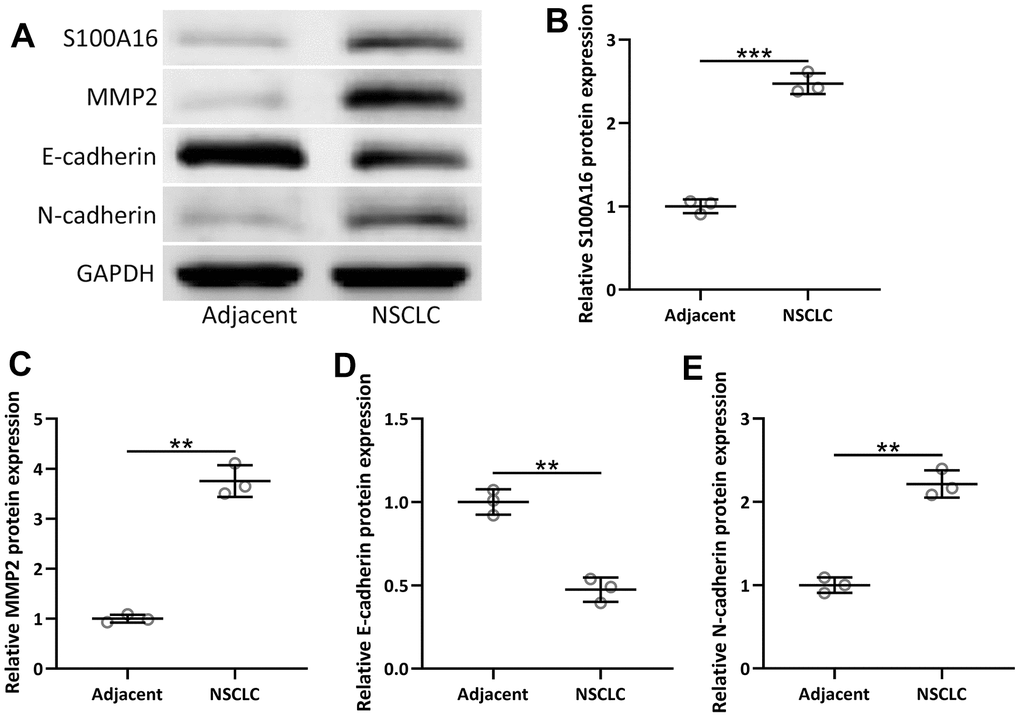 The protein expressions of S100A16, MMP2, N-cadherin and E-cadherin between adjacent tissues and NSCLC tissues (n = 92 for each). (A) Western blot was used to determine the protein expression. GAPDH was used as the loading control. The expressions were normalized to adjacent (B–E). Violin plot was used to show the data. *p 