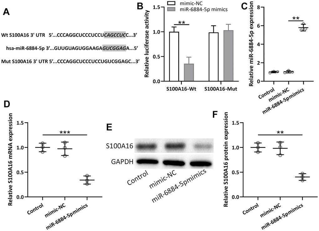 miR-6884-5p targeted S100A16 and regulated the expression of S100A16 in A549 cells. (A) The predicted binding sites of hsa-miR-6884-5p with wild-type 3′-UTR region of S100A16 mRNA are shown. A mutated 3′-UTR of S100A16 is also shown. (B) A549 cells were co-transfected with luciferase reporters containing Wt and/or mutant S100A16 3′-UTR with miR-6884-5p mimics and negative control. After 48 h of incubation, relative luciferase activities were measured. n = 3. Data were shown as means ± SD. **p C) and the mRNA expressions of S100A16 (D). Western blot was used to determine the protein expressions of S100A16 (E). GAPDH was used as the loading control and the expressions were normalized to control (F). n = 3. Data were shown as Mean ± SD. **p 