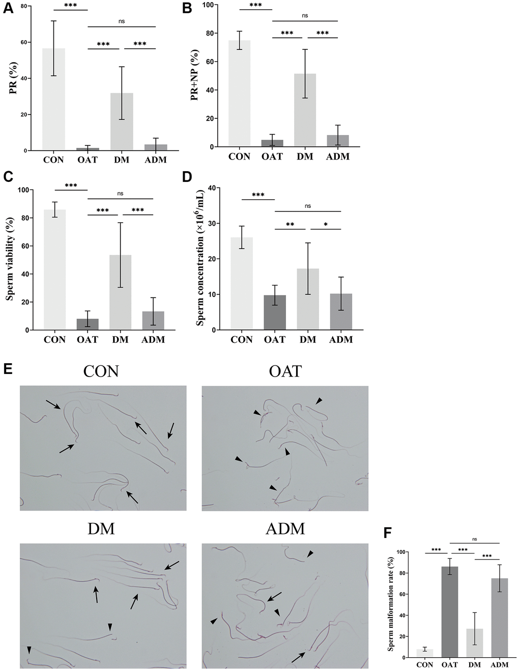 Effects of moxibustion on the sperm quality of rats with TGS-induced OAT. (A) PR. (B) PR+NP. (C) Sperm viability. (D) Sperm concentration. (E) Morphological changes of sperm observed using 2% eosin staining (×400). Black triangle: abnormal sperm; black arrow: normal sperm. (F) Sperm malformation rate. n = 10 in each group. *P **P ***P 