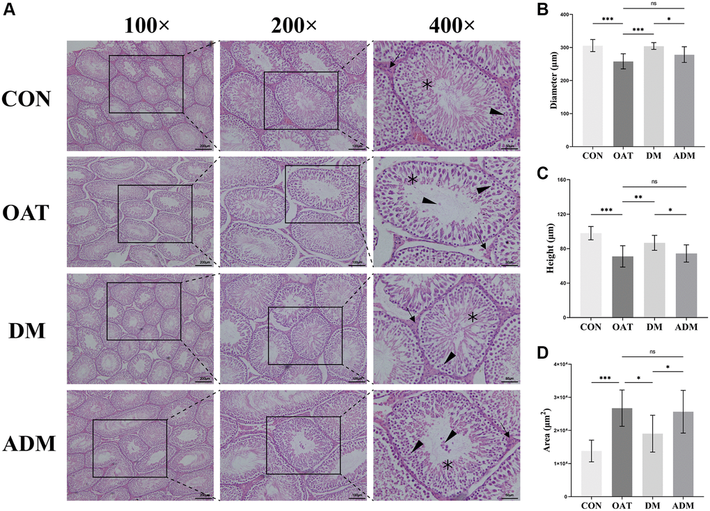 Moxibustion prevents testicular damage in rats with TGS-induced OAT. (A) Representative images of testicular histology detected by H&E staining (×100; ×200; ×400). Black triangle: spermatogenic cells; black arrow: Leydig cells; black asterisk: Sertoli cells. (B) Diameter of seminiferous tubules. (C) Height of the seminiferous epithelium. (D) Area of seminiferous tubules. n = 10 in each group. *P **P ***P 