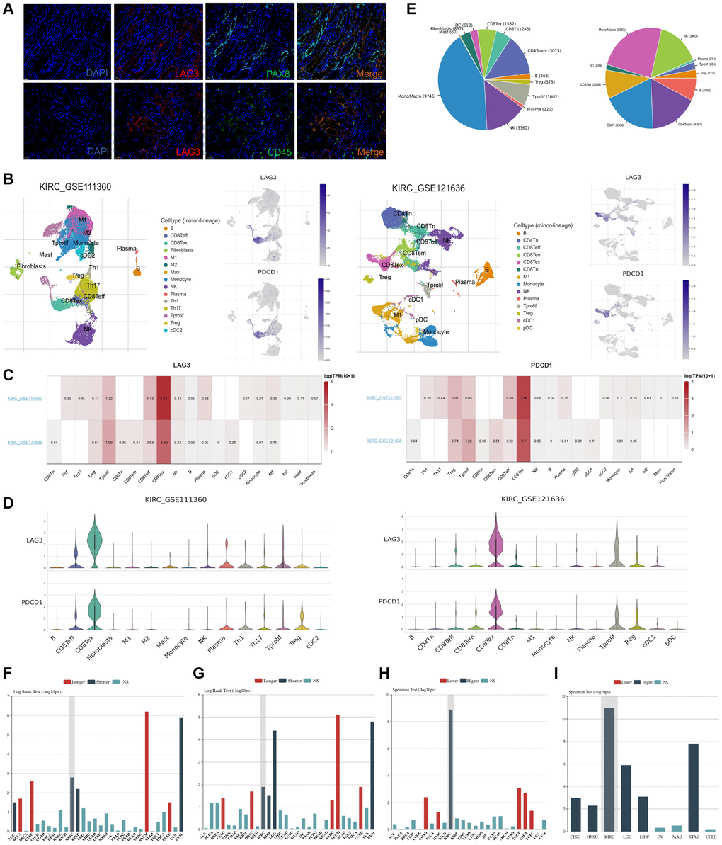 LAG3 and PDCD1 cell type distribution in KIRC by single-cell seq datasets and correlation of their expression trends. (A) Immunofluorescence staining of KIRC samples with DAPI (blue), LAG3 (red), CD45 (green), PAX8 (green), and the merged image (yellow) at 20× magnification, with a scale bar of 50 μm. (B) UMAP graph displays the distribution of cell types of LAG3 and PDCD1 expression in two single-cell seq datasets (KIRC