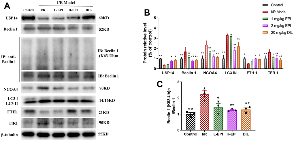 EPI regulates the expression of autophagy and ferroptosis related proteins in cardiac tissues. (A) Western blot analysis of USP14, Beclin 1, NCOA4, LC3 I, LC3 II, FTH1 and TfR1, Co-IP analysis of ubiquitination of K63 on Beclin 1. (B) Densitometric analysis of the bands was presented as the relative ratio of USP14, Beclin 1, NCOA4, LC3 I, LC3 II, FTH1, TfR1. (C) Densitometric analysis of the bands was presented as the relative ratio of K63 ubiquitination on Beclin 1. I/R + L-EPI: 1 mg/kg/day of EPI; I/R + H-EPI: 2 mg/kg/day of EPI. Data (n=3) are expressed as mean ± SD, *P  compared with I/R group, **P  compared with I/R group.