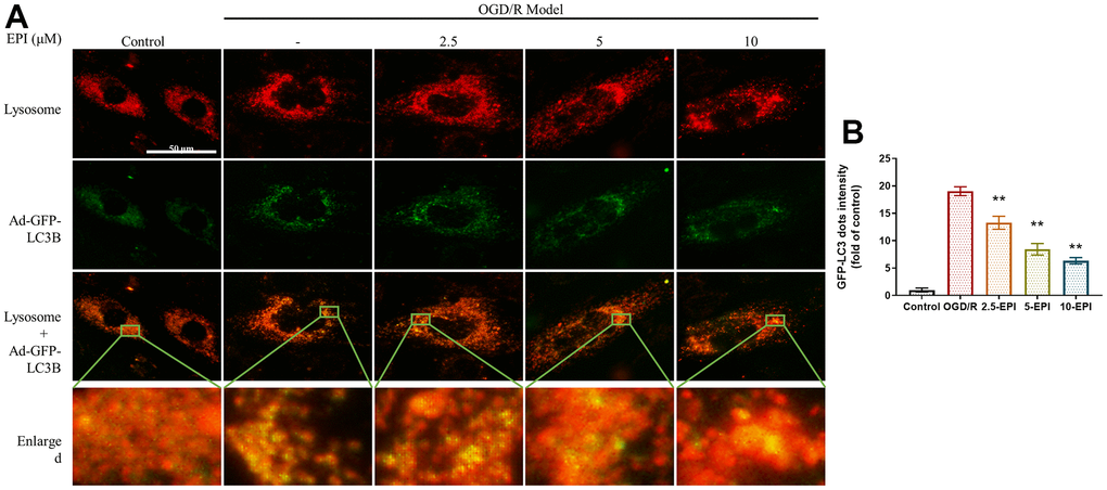 EPI up-regulates the expression of GFP-LC3 in H9C2 cells and lysosome. (A) Representative fluorescent images of GFP-LC3 and lysosomal co-staining in H9C2 cells. (B) GFP-LC3 dots intensity in H9C2 cells. 2.5-EPI: 2.5 μM EPI; 5-EPI: 5 μM; 10-EPI: 10 μM EPI. Data (n=3) are expressed as mean ± SD, *P  compared with OGD/R group, **P  compared with OGD/R group.