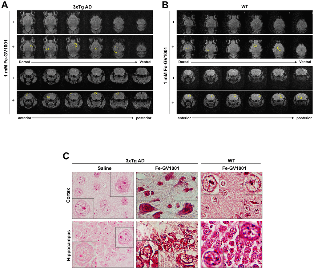 Penetrance of GV1001 into the brain through the blood-brain barrier. (A, B) We performed magnetic resonance imaging (MRI) to determine whether GV1001 could enter the brain. Ferrocenecarboxylic acid (Fe)-GV1001 (1 mg/kg) was subcutaneously injected into 3xTg-AD (12-month-old) and wild-type (WT) (8-month-old) mice. After 1 h, two-dimensional (2D) axial (Axl) fast field echo (FFE) and 2D coronal (Cor) FFE images were acquired using 3 T MRI. The entire brain was observed in several sections in the dorsoventral and anteroposterior planes using 2D Axl FFE and 2D Cor FFE images. This result shows that GV1001, represented by dark signals, entered the brains of both 3xTg-AD and WT mice (yellow circles in A and B, respectively). (C) Prussian blue staining.