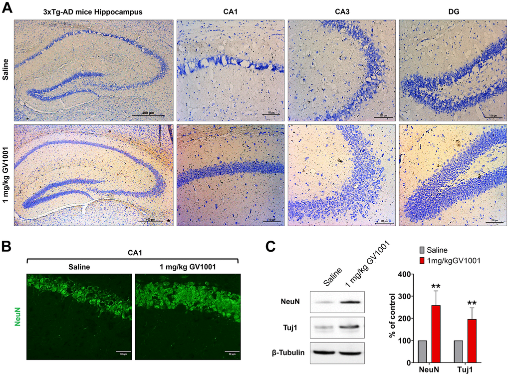 Effect of GV1001 on neurodegeneration. Markers of neurodegeneration were studied in aged 3xTg-AD mice treated with GV1001 and saline. (A) Neurodegeneration was evaluated by the volume of the CA1, CA3 and dentate gyrus (DG) in the hippocampus and (B, C) expression of neuronal markers, such as neuronal nuclei (NeuN) and neuron-specific β III tubulin (Tuj1) of the CA1 in the hippocampus. GV1001 markedly prevented neuronal loss in the hippocampus of 3xTg-AD mice. *P P 