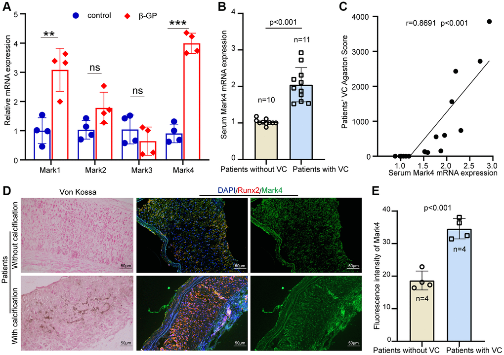 High level of Mark4 expression was associated with increased risk of vascular calcification. (A) The RT–qPCR showed expression of Marks 1- 4 in HASMCs with high phosphate (n = 4 per group). Error bar represent four independent experiments. **Means p ***p B) Mark4 mRNA level in serum from patients from CKD with (n = 11) or without VC (n = 10). (C) Correlation between the Mark4 mRNA level and VC scores in patients with CKD (n = 21, the Pearson’s correlation coefficient r value and the p-value are shown). (D) Von Kossa assay and IF staining for Mark4 in radial arteries sections from patients with CKD (n = 4 per group). Scale bars: 50 μm. (E) The bars showing fluorescence intensity of Mark4 in arteries between patients from CKD with or without VC (n = 4 per group). Error bar represent four independent experiments.