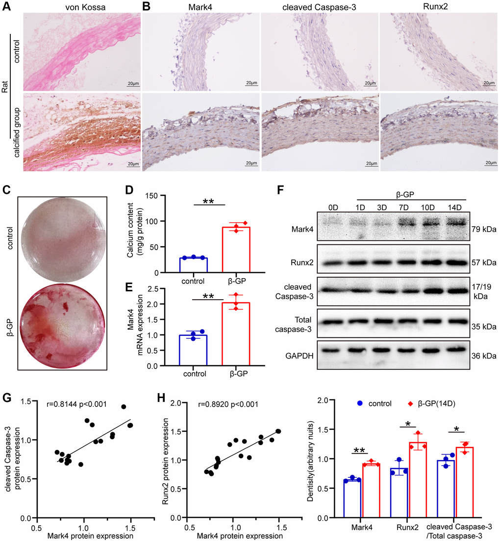 Mark4 was upregulated and associated with apoptosis in the aortas of calcified rats and β-GP-cultured VSMCs. (A) Von Kossa staining in the aortas of control rats and calcified rats. (B) Immunohistochemistry of Mark4, Runx2 and cleaved Caspase-3 expression in the aortas of control and calcified rats (n = 3 per group). Scale bars: 20 μm. (C) Alizarin Red S staining of VSMCs cultured with 10 mM β-glycerophosphate (β-GP) medium for 14 days. (D) Quantitative analysis of the calcium content in VSMCs after cultured with β-GP medium for 14 days compared with 0 days. **Means p E) RT–qPCR analysis of Mark4 mRNA expression in VSMCs at 14 days after β-GP induction compared with 0 days. Error bar represent three independent experiments. **Means p F) Western blot and statistical analyses of Mark4, Runx2 and cleaved Caspase-3 expression in VSMCs treated with β-GP for different days. Error bar represents three independent experiments. *Means p **p G) Correlation analysis between the protein expression of Mark4 and cleaved Caspase-3. (H) Correlation analysis between the protein expression of Mark4 and osteogenic marker Runx2 in β-GP-induced VSMCs.