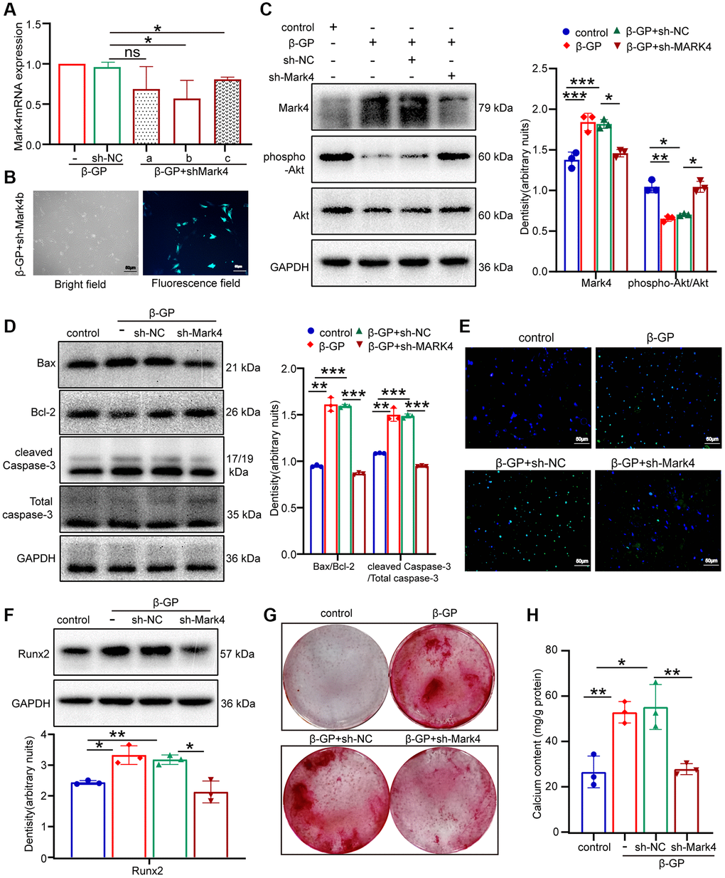 Mark4 knockdown inhibited β-GP-induced VSMCs apoptosis and calcification. VSMCs were infected with lentiviral shMark4 (sh-Mark4) or sh-negative control (sh-NC) under high phosphate conditions for 72 h. (A) The RT–qPCR showed transfection efficiency of sh-Mark4a-c in β-GP mediated VSMCs. *Means p B) The inverted fluorescence microscopy observation of sh-Mark4b transfection efficiency in β-GP-treated VSMCs. (C, D) Western blot and quantitative densitometry analysis of Mark4, Akt and apoptosis-related proteins in VSMCs with knockdown of Mark4. (E) Apoptosis of sh-Mark4 transfected VSMCs cultured with β-GP medium was assessed by TUNEL staining (green). Nuclei were counterstained with DAPI (blue). (F) Western blot and quantitative densitometry analysis of Runx2 in VSMCs with knockdown of Mark4. (G) Alizarin Red S staining and (H) calcium content in VSMCs infected with sh-Mark4. *Means p **p ***p *p **p ***p 