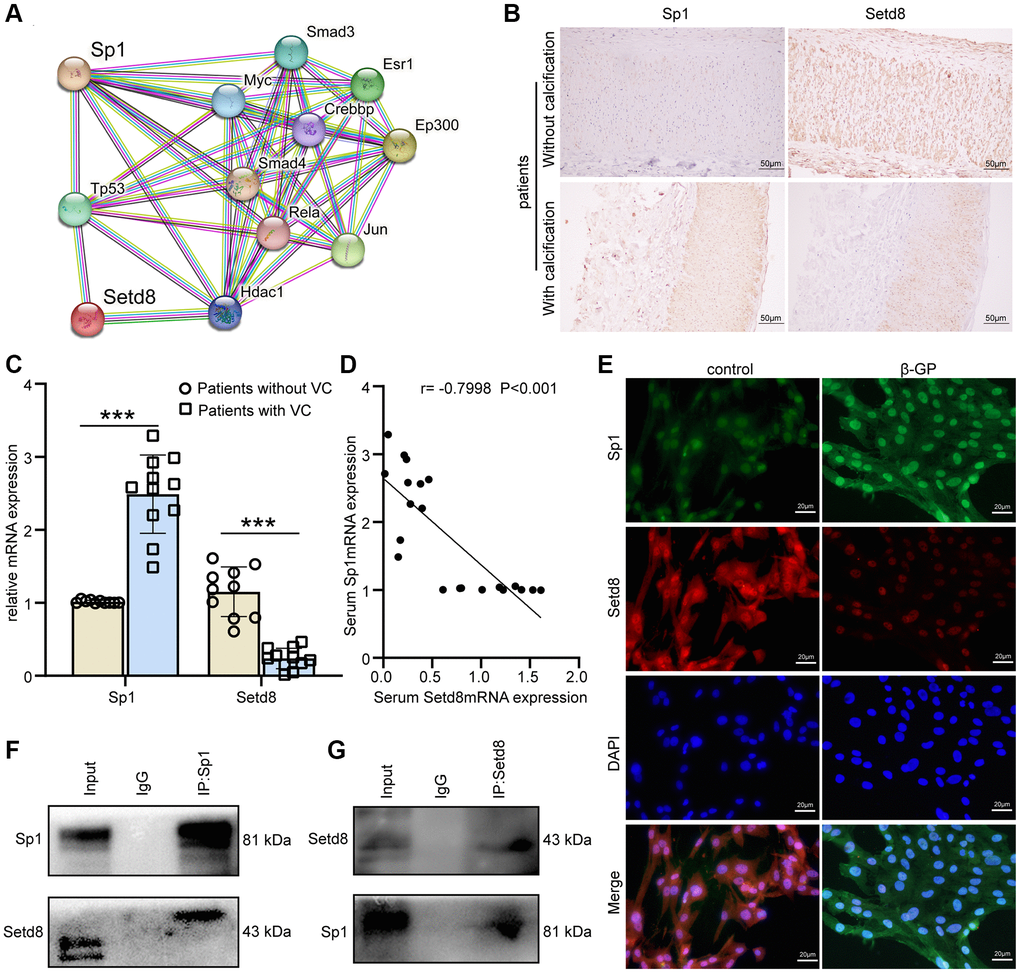 Sp1 interacted with Setd8 to regulate Mark4 expression in VSMCs. (A) Several proteins that interacted with Sp1 were shown (https://string-db.org). (B) Immunohistochemistry of Sp1 and Setd8 in CKD patients with or without arterial calcification. Scale bars: 50 μm. (C) RT–qPCR analysis of mRNA expression of Sp1 and Setd8 in serum from CKD patients with (n = 11) or without VC (n = 10). ***Means p D) Correlation analysis between the expression of Setd8 mRNA and Sp1 mRNA in CKD patients (n = 21, the Pearson’s correlation coefficient r value and the p-value are shown). (E) Representative IF images showing the colocalization of Sp1 and Setd8. Scale bars: 20 μm. (F, G) The association between Sp1 and Setd8 in VSMCs was confirmed by Co-IP.