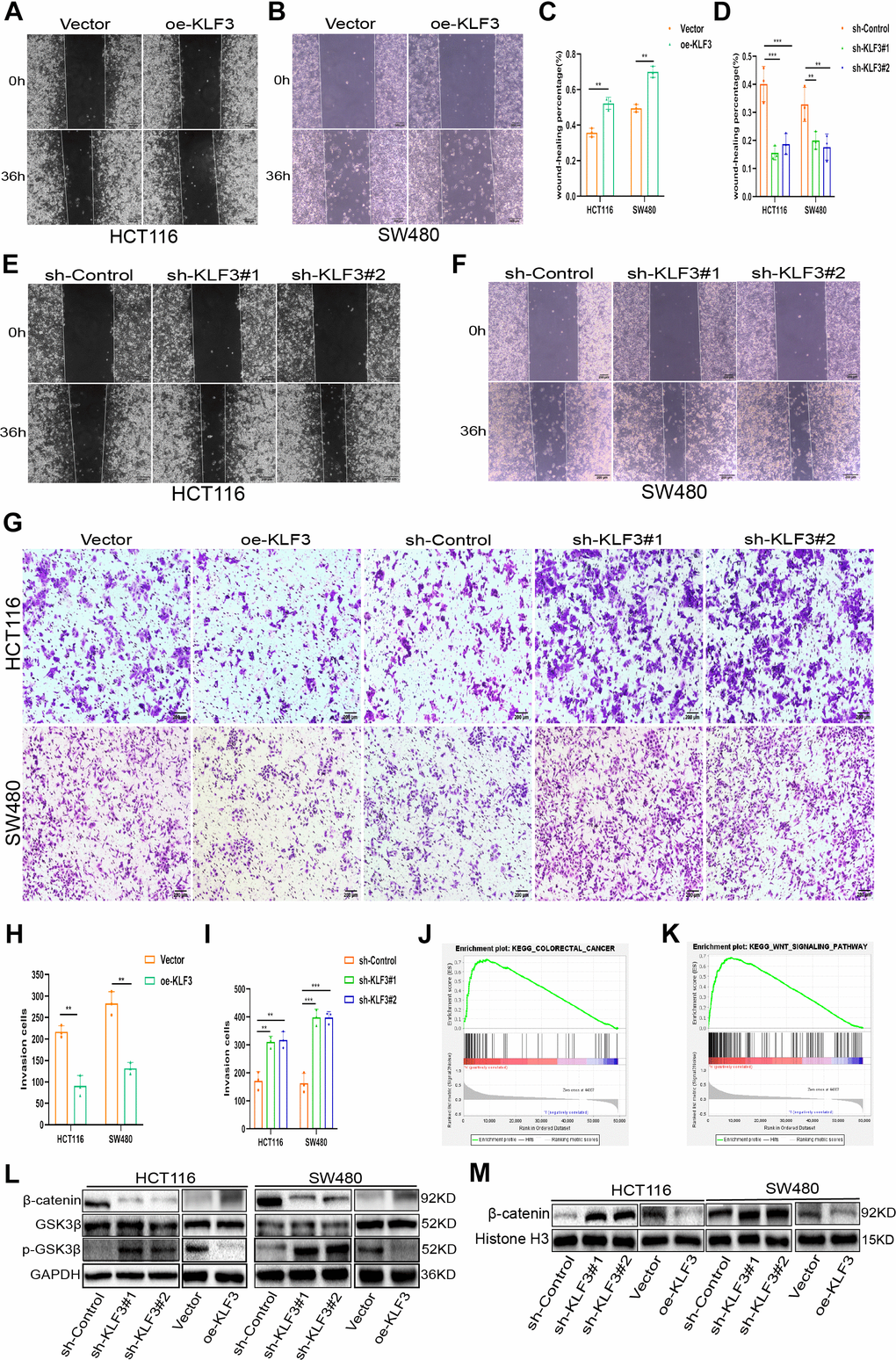 KLF3 knockdown enhances invasion in CRC cells and activates the WNT/β-catenin axis. (A–F) Representative wound-healing images showing migration in oe-KLF3 and KLF3-knockdown cells. The percentage was calculated according to the change in distance between each side. (G–I) Representative images showing the invasive capacity of CRC cells with up- and down-regulated KLF3 expression. (J, K) GSEA showing positive correlations between KLF3 expression, CRC progression, and the WNT/β-catenin axis. (L, M) Levels of markers associated with the WNT/β-catenin axis, including GSK3β, p-GSK3β (Ser9), and nuclear β-catenin in oe-KLF3 and KLF3-knockdown CRC cells. The data represent means ± standard deviation. Scale bars: 50 μm. **p 