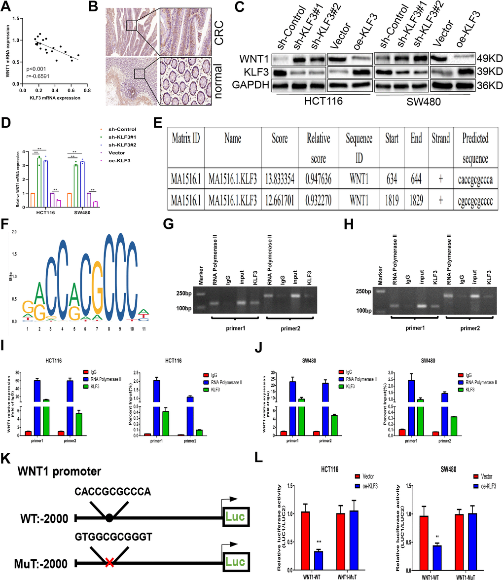 Krüppel-like factor 3 (KLF3) correlates positively with WNT1 expression. (A) Pearson’s correlations showing the relationship between KLF3 and WNT1 expression. (B) WNT1 levels were higher in CRC samples than in normal tissues, as shown by immunohistochemical analysis. (C, D) mRNA and protein levels of WNT1 and KLF3 in HCT-116 and SW480 CRC cell lines, shown by qPCR and western blotting, respectively, after KLF3 knockdown or overexpression. (E) Potential interaction sites between KLF3 and WNT1 according to the JASPAR database. (F) Diagram illustrating the predicted interaction site for KLF3 in the WNT1 promoter. (G–J) Verification of KLF3 interaction with the WNT1 promoter region in CRC cells, shown by ChIP-qPCR and agarose gel electrophoresis. (K, L) Luciferase assays exhibited a significant inhibition of luciferase activity the oe-KLF3 group within the wild-type WNT1 promoter relative to the controls. No response to oe-KLF3 was seen with the mutant WNT1 promoter. ****P