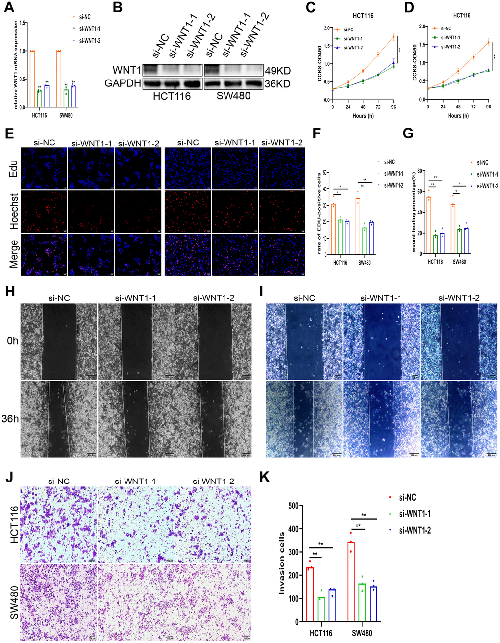 Knockdown of WNT1 attenuates proliferation and invasion in CRC. (A, B) WNT1 mRNA and protein levels in CRC cells following transfection with si-WNT1 or si-NC. (C–K) Alleviation of the malignant phenotype in CRC cells, shown by CCK-8, EdU, wound healing, and invasion assays. Knockdown of WNT reduced nausea in CRC cell lines HCT116 and SW480, as demonstrated by assays mentioned in (C–K). Scale bars: 50 μm, 200μm. *p 