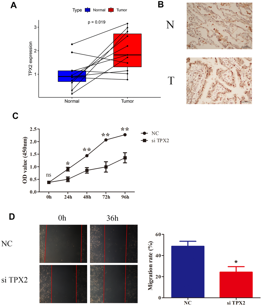 Knockdown of TPX2 inhibited proliferation and migration of LUAD. (A) TPX2 mRNA expression levels were higher in 11 LUAD tissues than that in matched normal tissue samples. Y-axis data presents relative expression (normalized to GAPDH; calculated using the 2−ΔΔCt method). (B) Immunohistochemical analysis of TPX2 in LUAD tissues. Representative images are shown. (C) CCK8 assay suggested that knockdown of TPX2 inhibited the proliferation of A549 cells. (D) The wound healing assay suggested that knockdown of TPX2 reduced cell migration of A549 cells. *p
