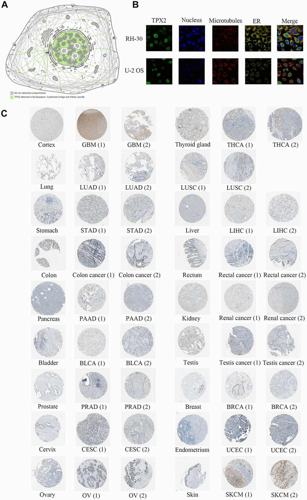 Protein expression analysis of TPX2 in the HPA database. (A) TPX2 was detected in nucleoplasm, cytokinetic bridge and mitotic spindle. (B) Immunofluorescence staining of the subcellular localization of TPX2 in RH-30 and U-2 OS tumor cells. (C) Representative immunohistochemical staining of TPX2 in normal and tumor tissues of different cancer types.