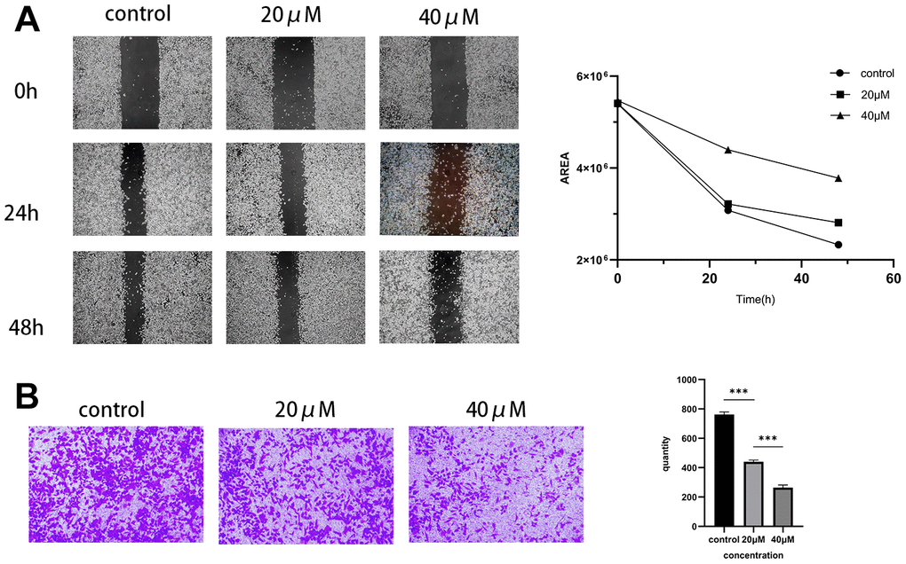 Effect of Taxifolin on the immigration and invasion capacity of MIA PaCa-2 pancreatic cancer cells. (A) Scratch assay to examine the migration of MIA PaCa-2 cells affected by Taxifolin. (B) Transwell assay was conducted to evaluate the effect of Taxifolin on the invasion of MIA PaCa-2 cells.