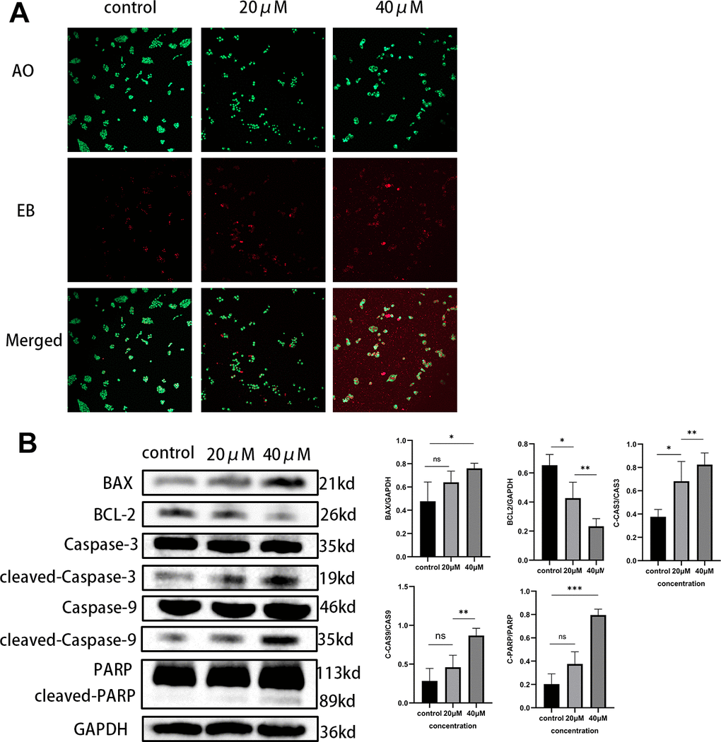 (A) MIA PaCa-2 cells were double-stained with AO/EB after Taxifolin treatment. (B) The expression of apoptosis-related proteins in MIA PaCa-2 cells after Taxifolin treatment.