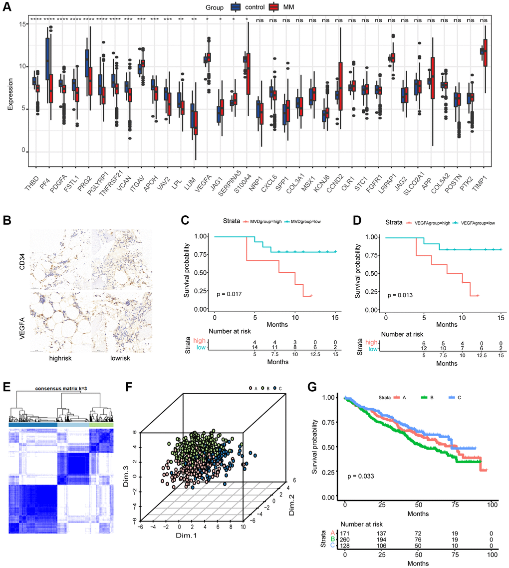 Differential expression of AAGs in MM and generation of angiogenesis subgroups. (A) Differences in the expression of AAGs between MM patients and healthy controls (*P **P ***P ****P B) Representative images of MM patient BM tissues stained with CD34 and VEGFA antibodies (scale bar, 50 μm). Overall survival analyses of the MVD group (C) and VEGFA group (D) using Kaplan–Meier curves. (E) Consensus matrix heatmap depicting three gene clusters associated with the AAGs. The colors indicate the similarity or dissimilarity among samples at each iteration, with blue indicating higher similarity and white indicating lower similarity. (F) PCA based on the AAGs revealed three disjointed populations. Red, cluster A samples; green, cluster B samples; blue, cluster C samples. (G) OS analysis of patients in the AAG