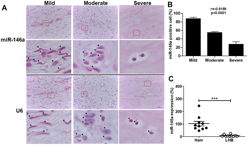 miR-146a expression in tendon tissues from human long head of biceps (LHB) with tendinopathic changes. (A) Representative figures of in situ hybridization of miR-146a in LHB tendons with different severity grades. Arrow heads indicate miR-146a- or U6-positive cells. Scale bars represent 50 μm in × 400 magnifications. The higher-magnification views of the red-boxed areas are shown beneath them. (B) miR-146a-positive cells were counted and normalized with U6-counterstained total cells. Spearman correlation rank test was used. (C) miR-146a expression levels in tendon tissues of normal hamstring (Ham) tendon during anterior cruciate ligament reconstruction and LHB, as determined by quantitative reverse-transcription polymerase chain reaction (qRT-PCR). Values are represented as the mean ± standard error of the mean (SEM). n=10 each, ***p