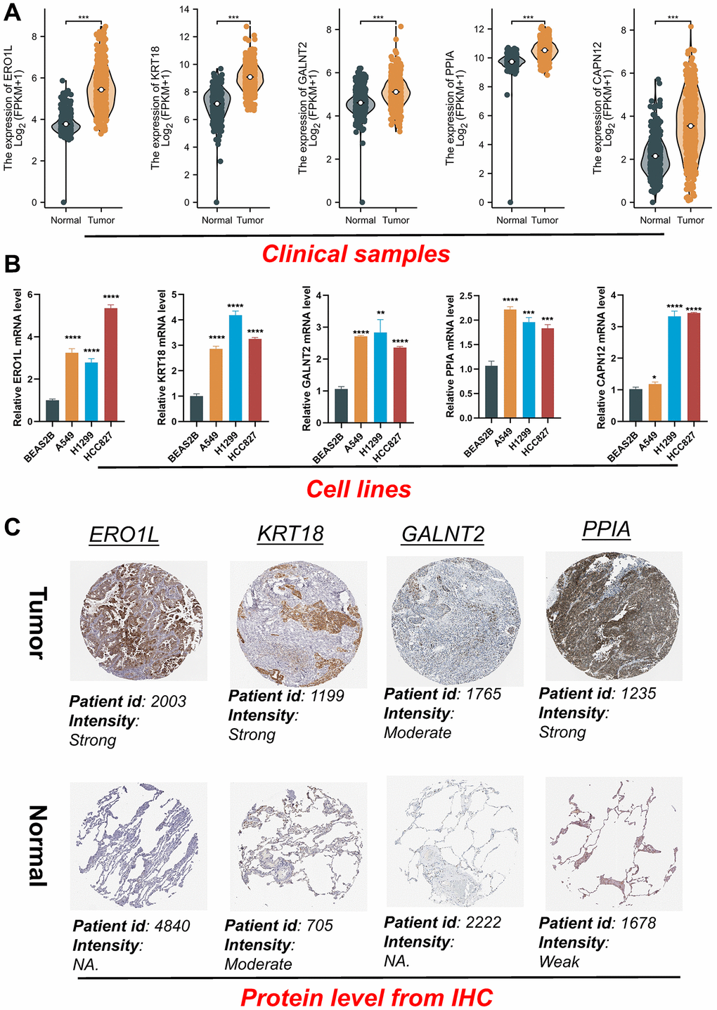 Validation of the expression patterns of five signature genes. (A) The gene mRNA expressions of five signature genes in the normal and tumor tissues. (B) Five signature genes expression in normal and LUAD cell lines. (C) Immunohistochemistry of the ERO1L, KRT18, GALNT2, PPIA in the normal and tumor groups from the HPA database. *P **P ***P ****P 